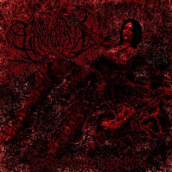 Gastrectomy - Whore Gushing Brutality (2025)